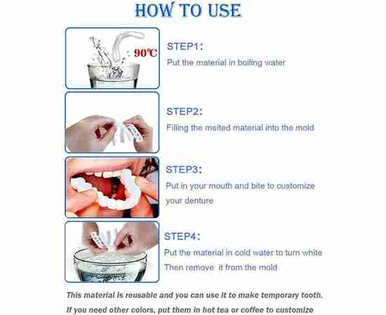 Snap-On Smile | Perfect Smile Teeth Veneer